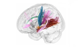 A clear model of a human brain shows colorful thin lines moving from one part of the brain to another.